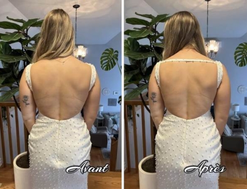 Backless wedding dress alteration